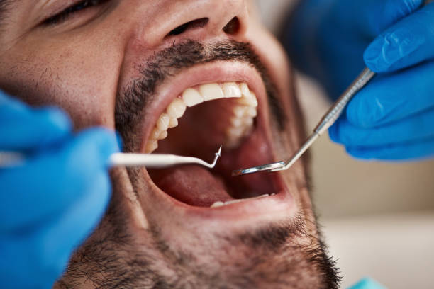 Best Pediatric Emergency Dentist in Johns Creek, GA